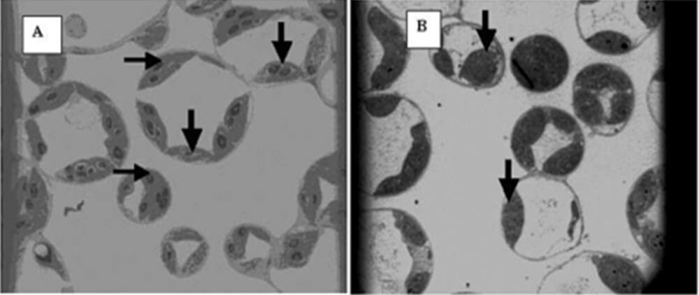 Modificación de los cloroplastos de banano 